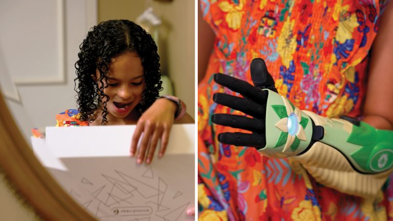 9-year-old Disney fan Elisa was gifted the first-ever bionic arm cover inspired by Disney’s Princess Tiana